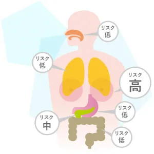 複数のがんリスクを同時に算出