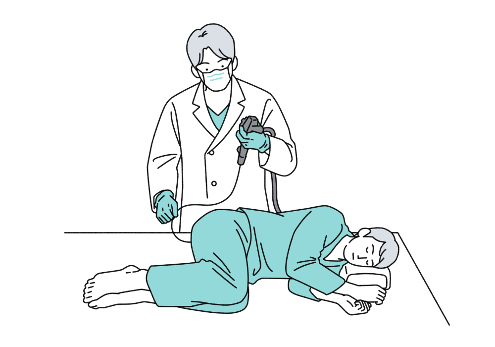 大腸カメラ(大腸内視鏡検査)